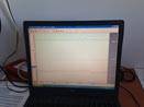 nregistrement signal Périflux